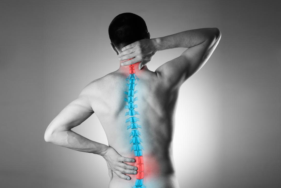Homeopathy for Chronic back pain